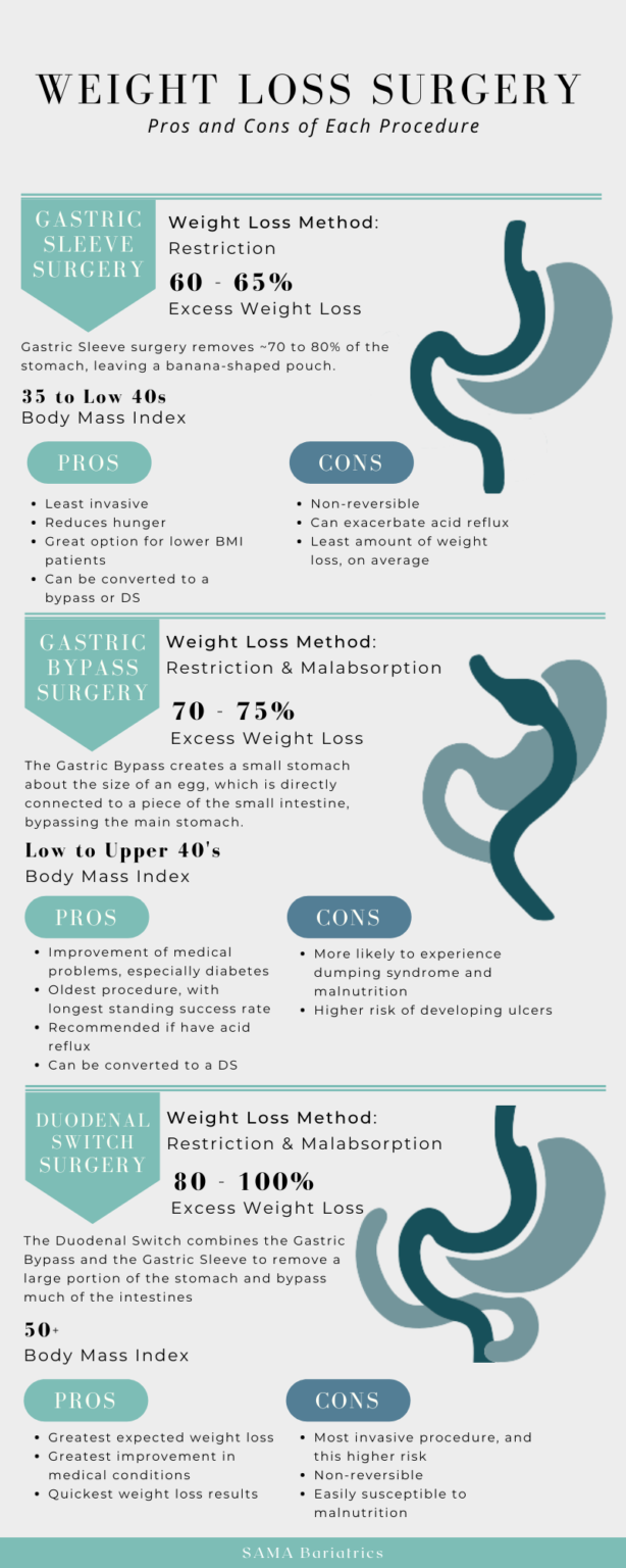 Choosing the Best Bariatric Surgery Procedure | SAMA Bariatrics