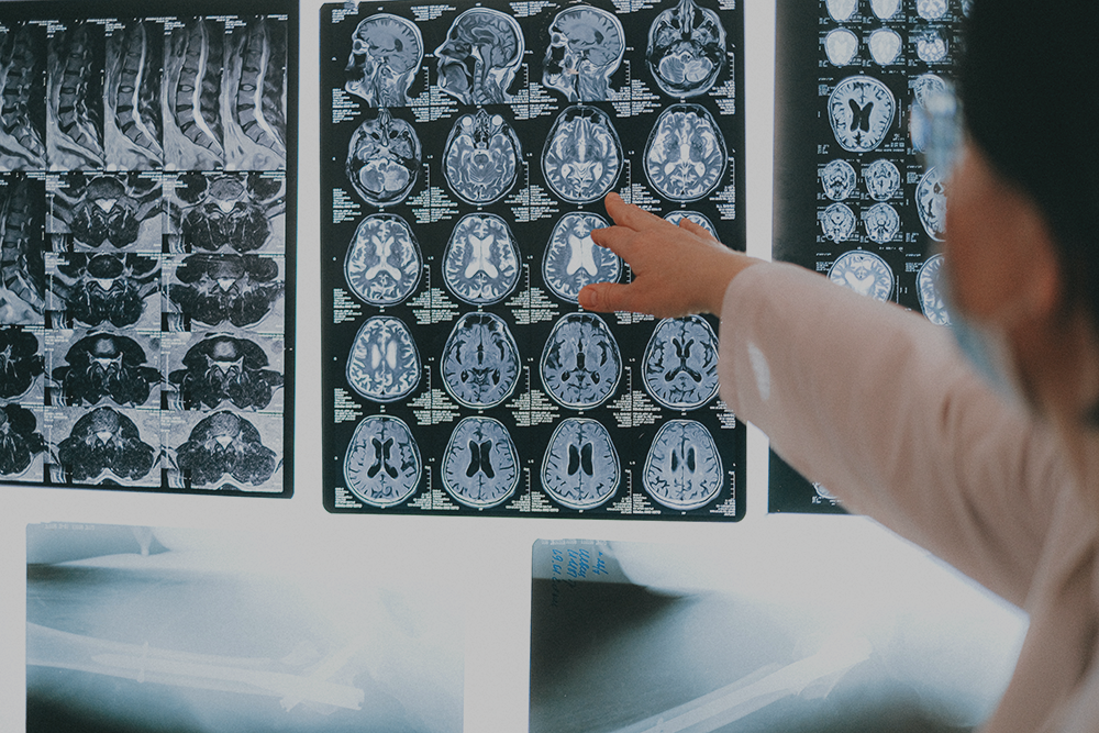 Obesity Affects the Brain